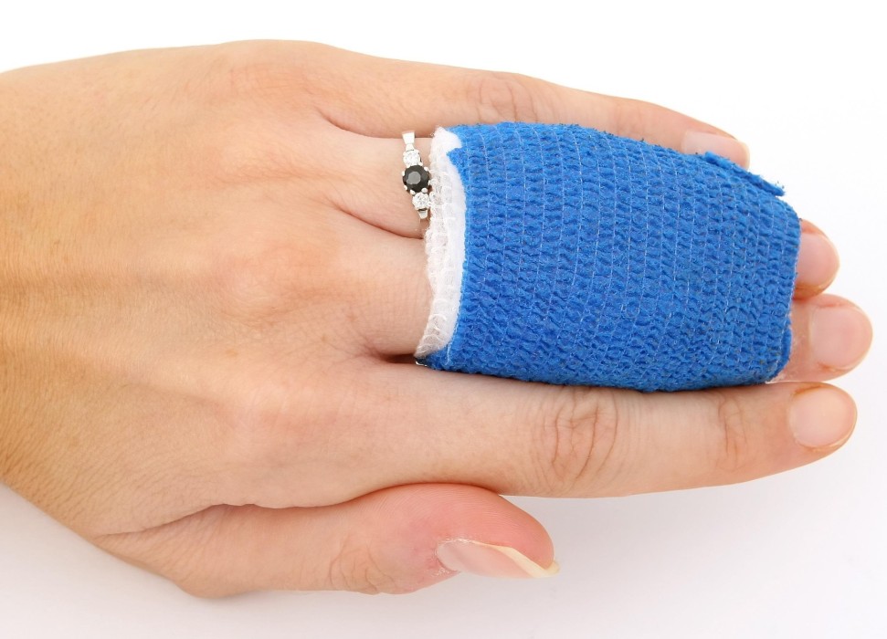 Hand mit zwei verbundenen Fingern